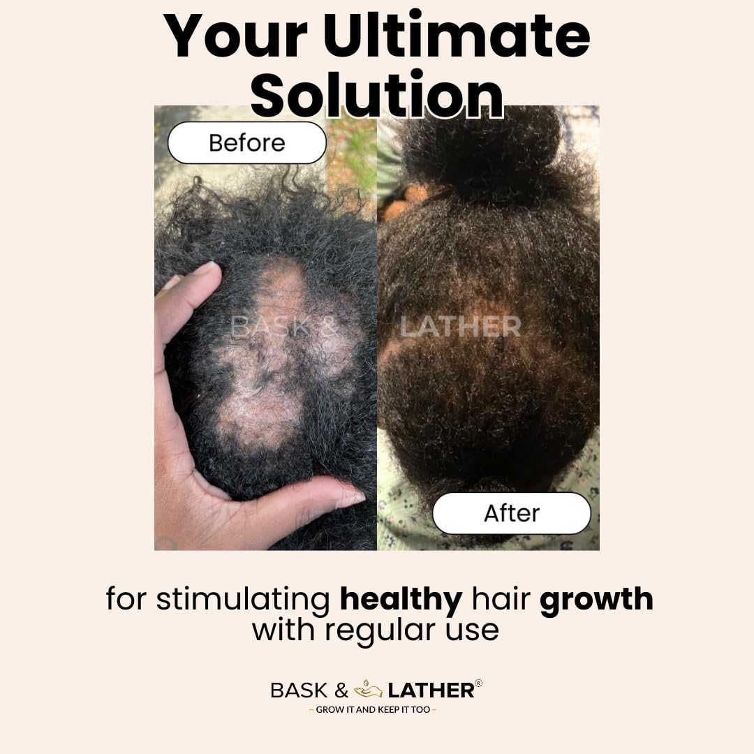 Bask & Lather Scalp Stimulator Hair Growth Oil